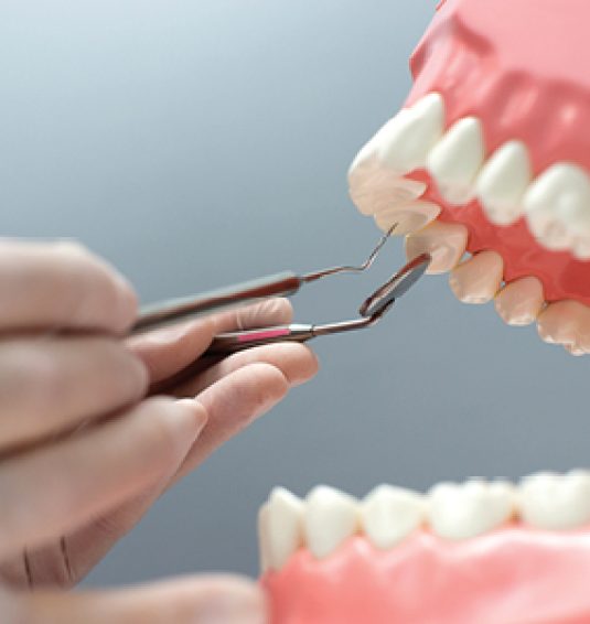 enfermedad-periodental